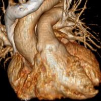 Ioannis Loumiotis, MD : Cardiac Surgeon