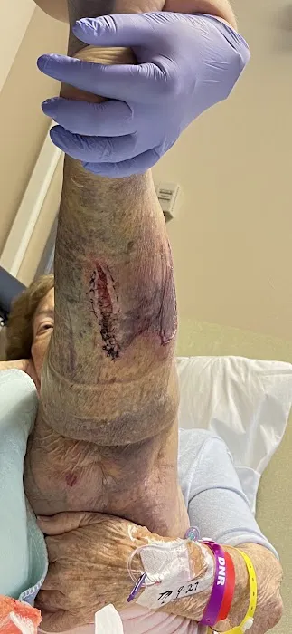 Stacy D. Brewington, MD FACC 1