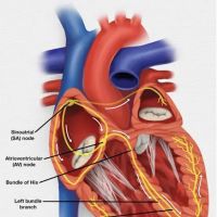 Aseem D. Desai, MD, FHRS