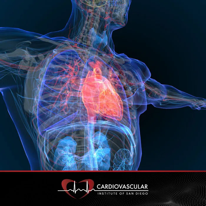 Cardiovascular Institute of San Diego 5