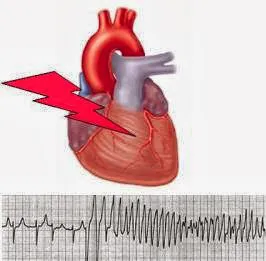 Cardiac Arrhythmia Associates 2