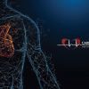 cardiovascular institute of san diego8705