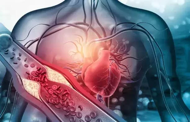 Advancements in Heart Disease Research: Latest Discoveries and Treatment Innovations
