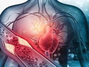Advancements in Heart Disease Research: Latest Discoveries and Treatment Innovations