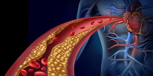 The Truth About Cholesterol and Heart Disease: What You Need to Know