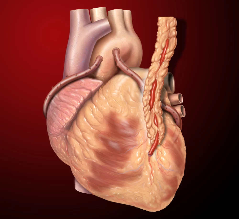 Exploring the Benefits of Minimally Invasive Heart Surgeries
