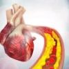 How High Cholesterol Contributes to Heart Disease: Key Insights