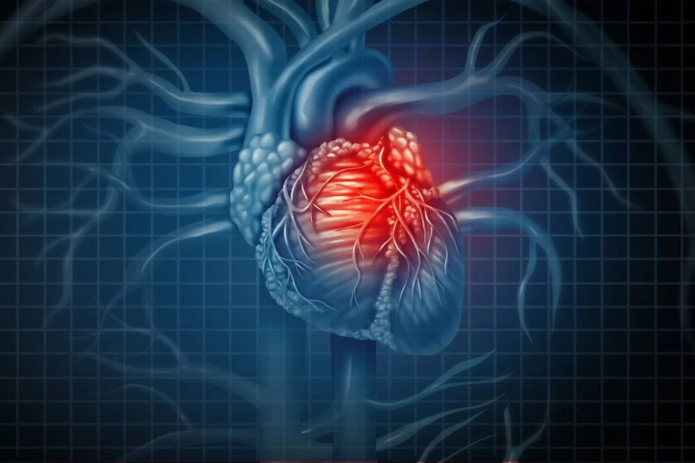 Why Men and Women Experience Heart Disease Differently: Key Differences and Insights