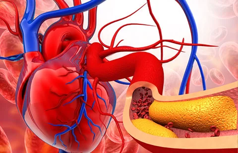 Cholesterol Management for Heart Disease Prevention: Effective Strategies for a Healthy Heart