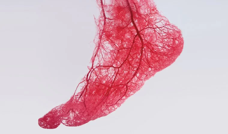 How Cardiologists Help Manage Peripheral Artery Disease: Expert Insights & Effective Treatments
