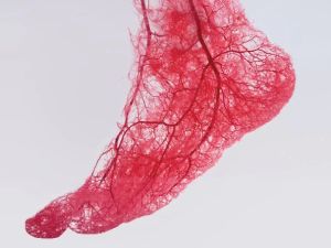 How Cardiologists Help Manage Peripheral Artery Disease: Expert Insights & Effective Treatments