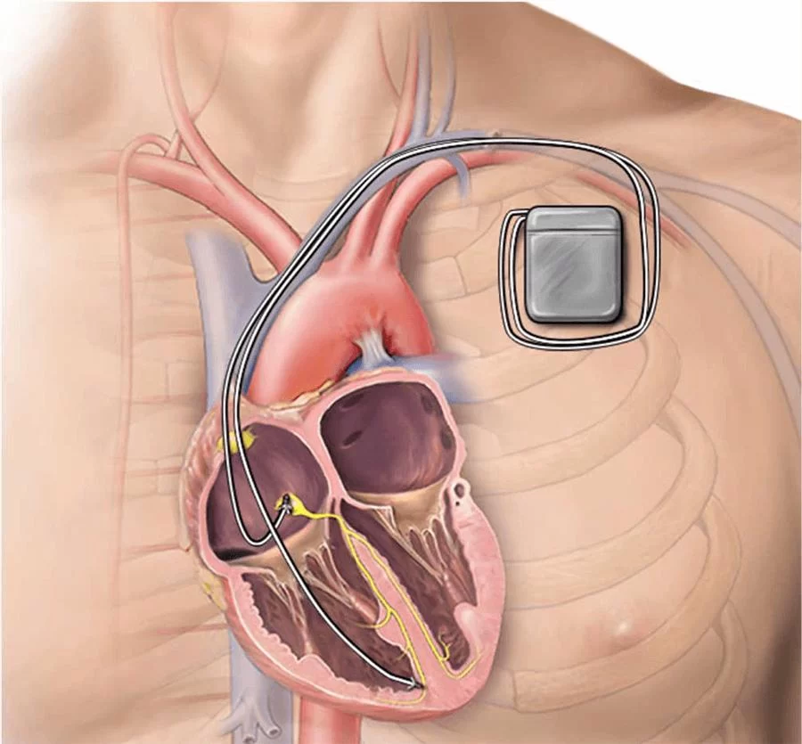 Heart Care Consultations with Experts Near Me – Find Trusted Heart Health Professionals
