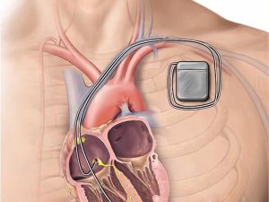 Heart Care Consultations with Experts Near Me – Find Trusted Heart Health Professionals