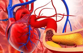 How to Find a Heart Specialist for Managing High Cholesterol