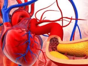 How to Find a Heart Specialist for Managing High Cholesterol