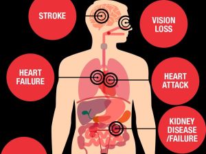 How Heart Disease Impacts Physical Activity and Health