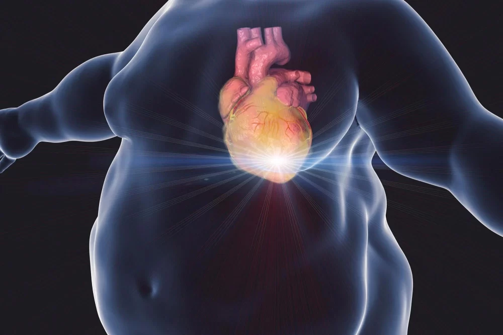 The Link Between Obesity and Heart Disease Risk: What You Need to Know