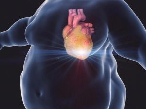 The Link Between Obesity and Heart Disease Risk: What You Need to Know