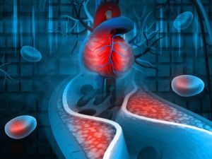 Understanding Cholesterol Levels and Heart Disease: Essential Insights for Better Heart Health