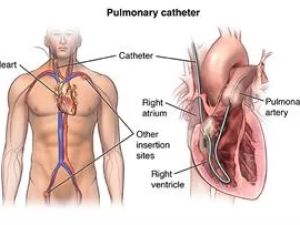 What to Expect During a Cardiac Catheterization: A Detailed Guide