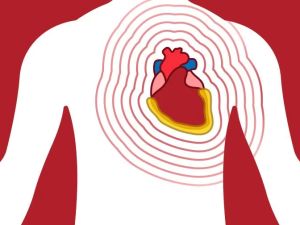 Stem Cell Therapy for Heart Disease Treatment: A Revolutionary Approach
