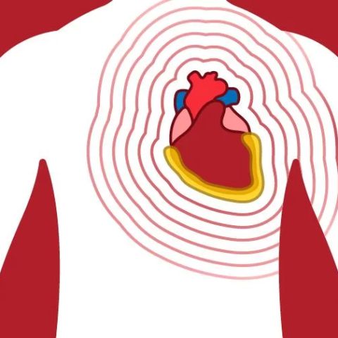 Stem Cell Therapy for Heart Disease Treatment: A Revolutionary Approach