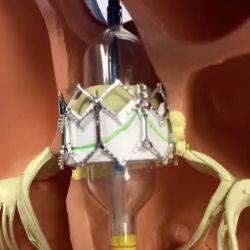 Arizona Heart Specialists ico