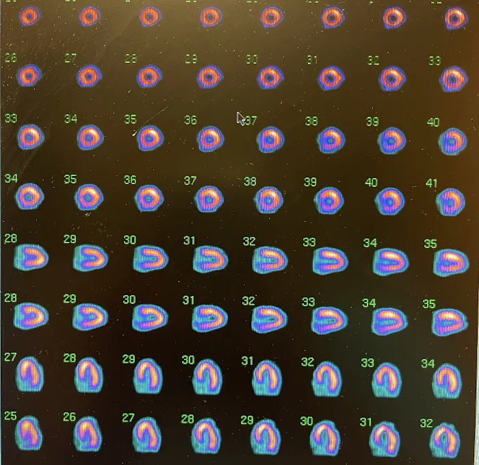 Arizona Heart Specialists 6