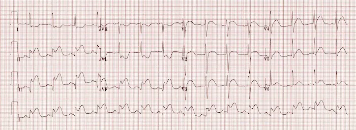 Salman Akhtar, MD 0
