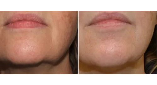 Obecano Anti Aging & Preventative Medicine 5