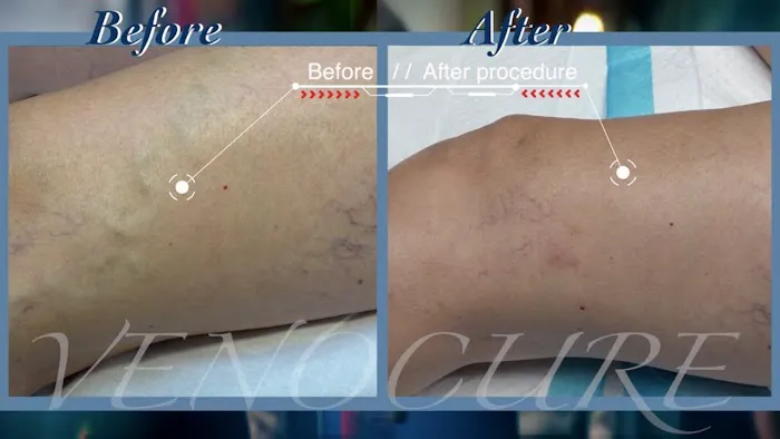 Venocure - Vein & Heart Specialists 0