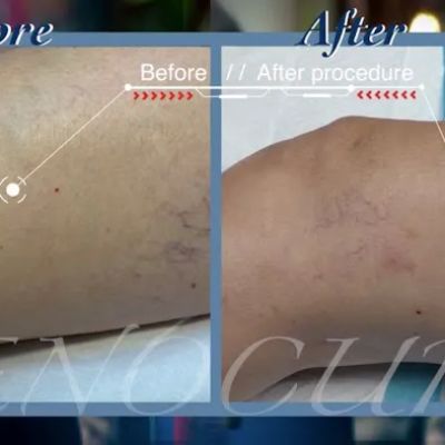 Venocure - Vein & Heart Specialists