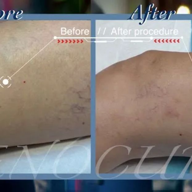Venocure - Vein & Heart Specialists