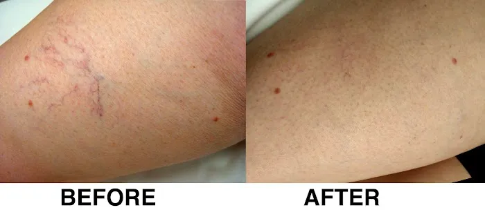 Venocure - Vein & Heart Specialists 4