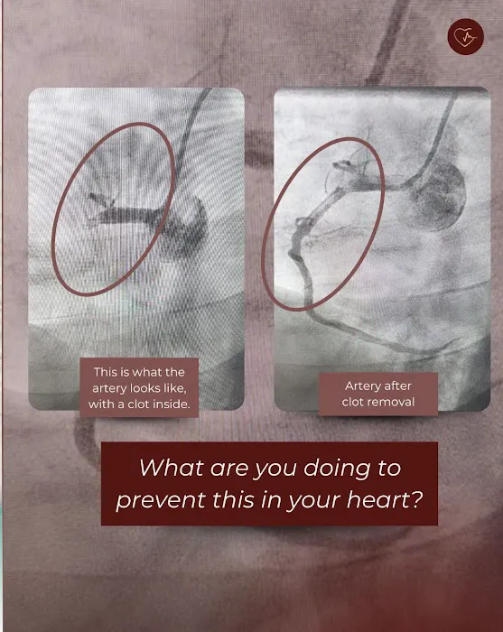 Garcia Heart and Vascular 4