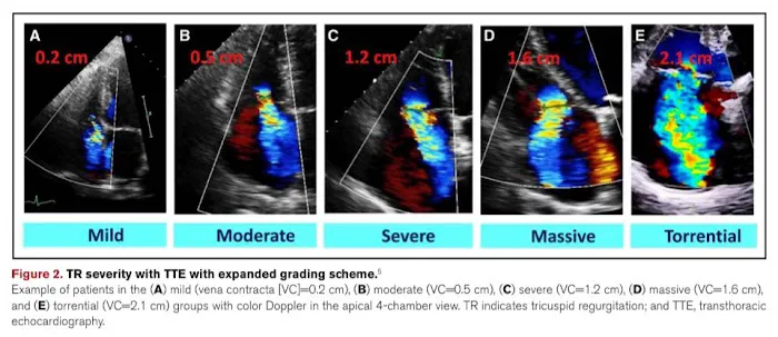 Houston Cardiovascular care - Dr. Abdelkader Almanfi 5