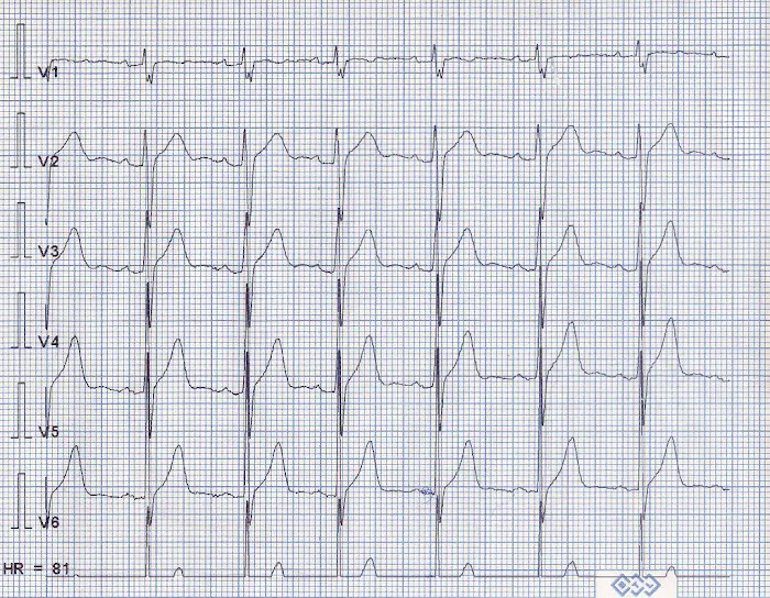 Ira H. Lieber, M.D., F.A.C.C 1