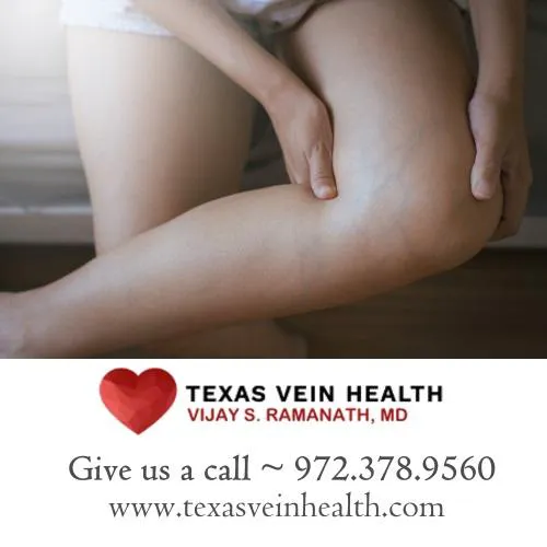 Texas Vein Health - Dr. Vijay S. Ramanath 5
