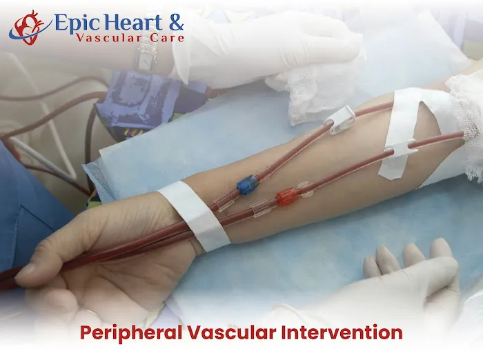 Epic Heart And Vascular Care 2