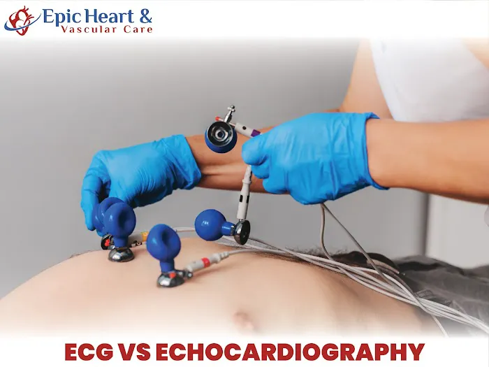 Epic Heart And Vascular Care 4