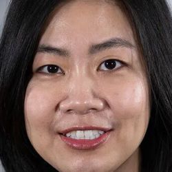 Tanyanan Tanawuttiwat, MD - IU Health Physicians Cardiology ico