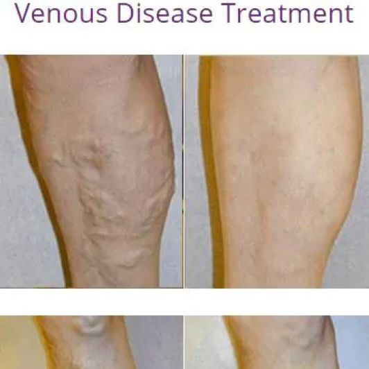 Glen Noble Dougherty, Jr., MD