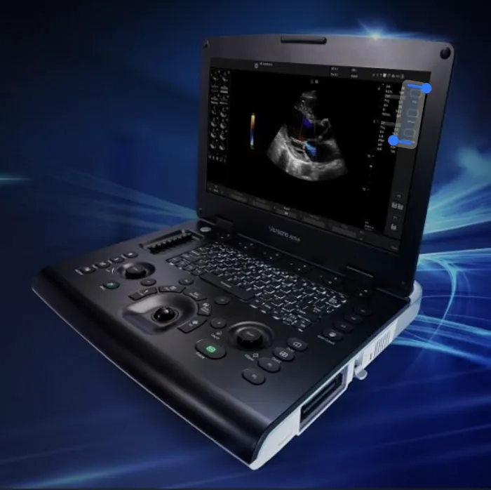 Mobile Ultrasound Solutions 2