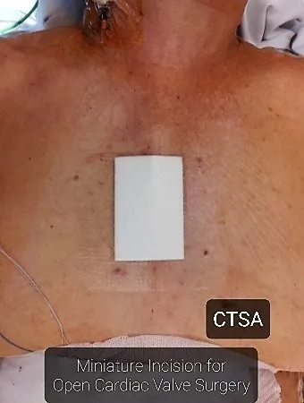 Cardiac and Thoracic Surgery Associates, LLC 2