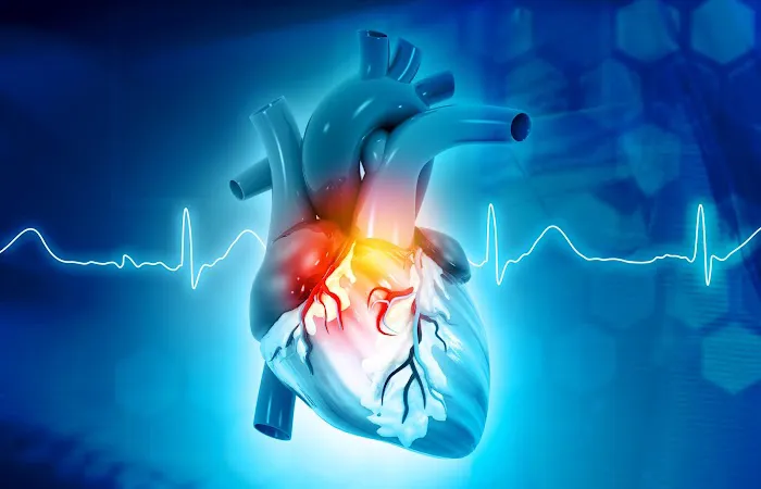 Cardiovascular Associates of America - CVAUSA 1