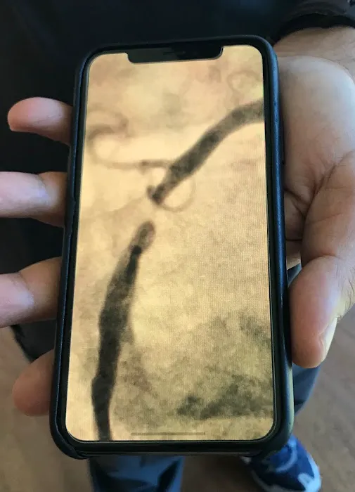 Heart Vein & Vascular: Babak Alex Vakili, MD 5