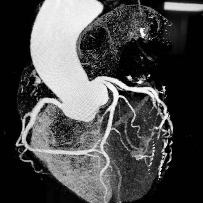 South Tampa Cardiology & Advanced Imaging Center: Alberto Morales, MD 8