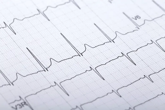 Sunshine Cardiovascular & Vein: Satish Sivasankaran, MD., MRCP(UK)., FACC., MBA. 4