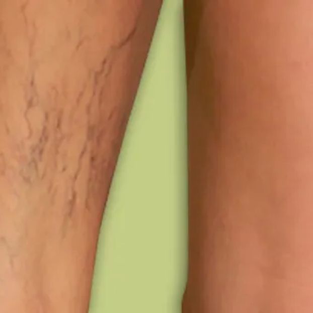 Heart Care 360 Cardiology & Vein Center—Dr.Vinod Raxwal