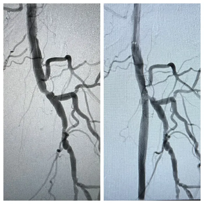 IVY Cardiovascular & Vein Center 6